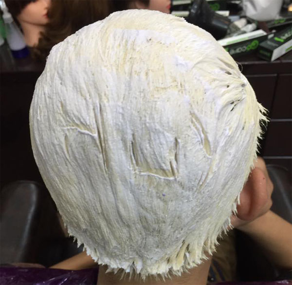 Tẩy tóc khiến da đầu bị bỏng rát